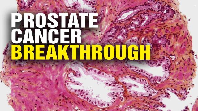 Prostate Cancer Breakthrough 6320